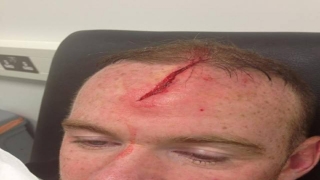 Man Utd's Rooney uses injury picture to defend England withdrawal